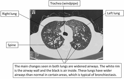 labelled-CT-slice.png