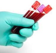 Blood sample tubes.jpg